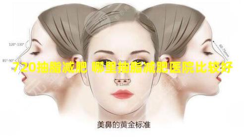 720抽脂减肥 哪里抽脂减肥医院比较好
